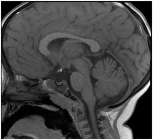 ARRS Case-Based Neuroradiology Imaging Review 2014