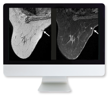 ARRS Clinical Breast Imaging Review 2009