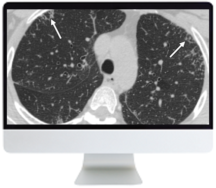 ARRS Clinical Case-Based Review of Cardiopulmonary Imaging 2019