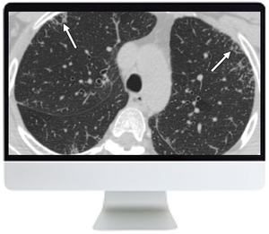 ARRS Clinical Case-Based Review of Cardiopulmonary Imaging 2019