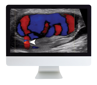 ARRS Clinical Ultrasound Review 2017