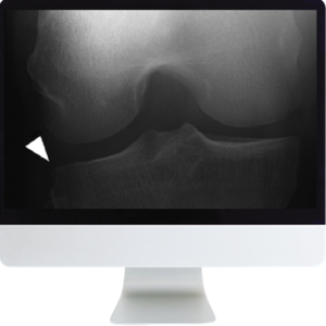 ARRS Musculoskeletal Imaging for the Practicing Radiologist 2018