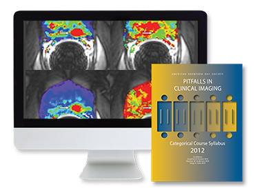 ARRS Pitfalls in Clinical Imaging 2008