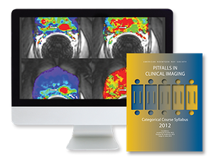 ARRS Pitfalls in Clinical Imaging 2008