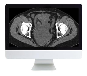 ARRS Radiologic Reasoning A Rapid-Fire Multispecialty Review 2018