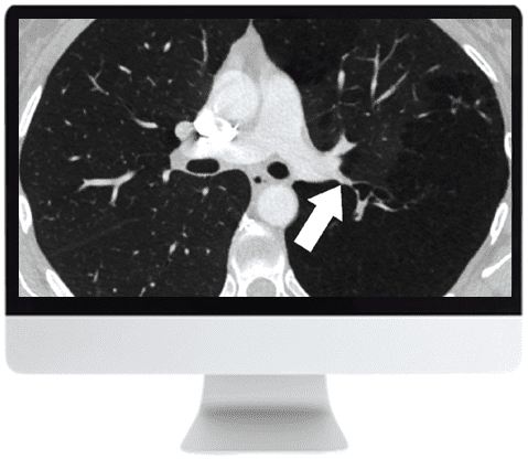 ARRS Basic Chest Imaging 2019 (CME VIDEOS)