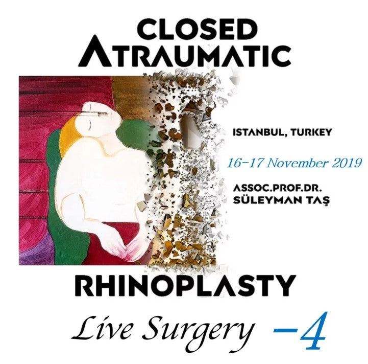 Closed Atraumatic Rhinoplasty Live Surgery DVD 4 2019