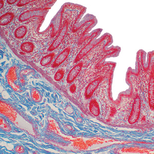 Current Topics in Gastrointestinal and Liver Pathology 2022