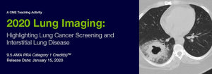 Edusymp 2020 Lung Imaging Highlighting Lung Cancer Screening and Interstitial Lung Disease