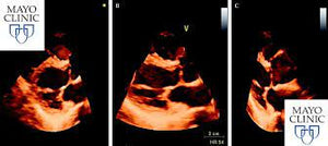 Mayo Clinic Echocardiography Board Review 2019-2020