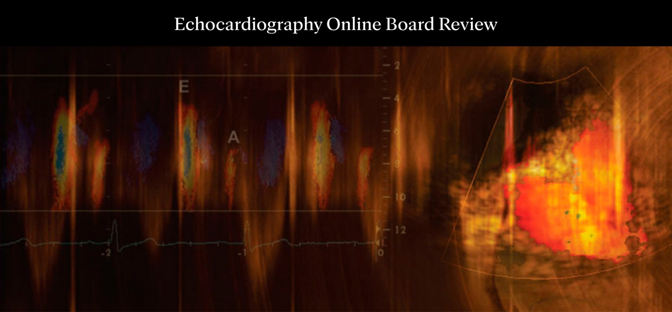 Mayo Clinic Echocardiography Online Board Review Course 2022