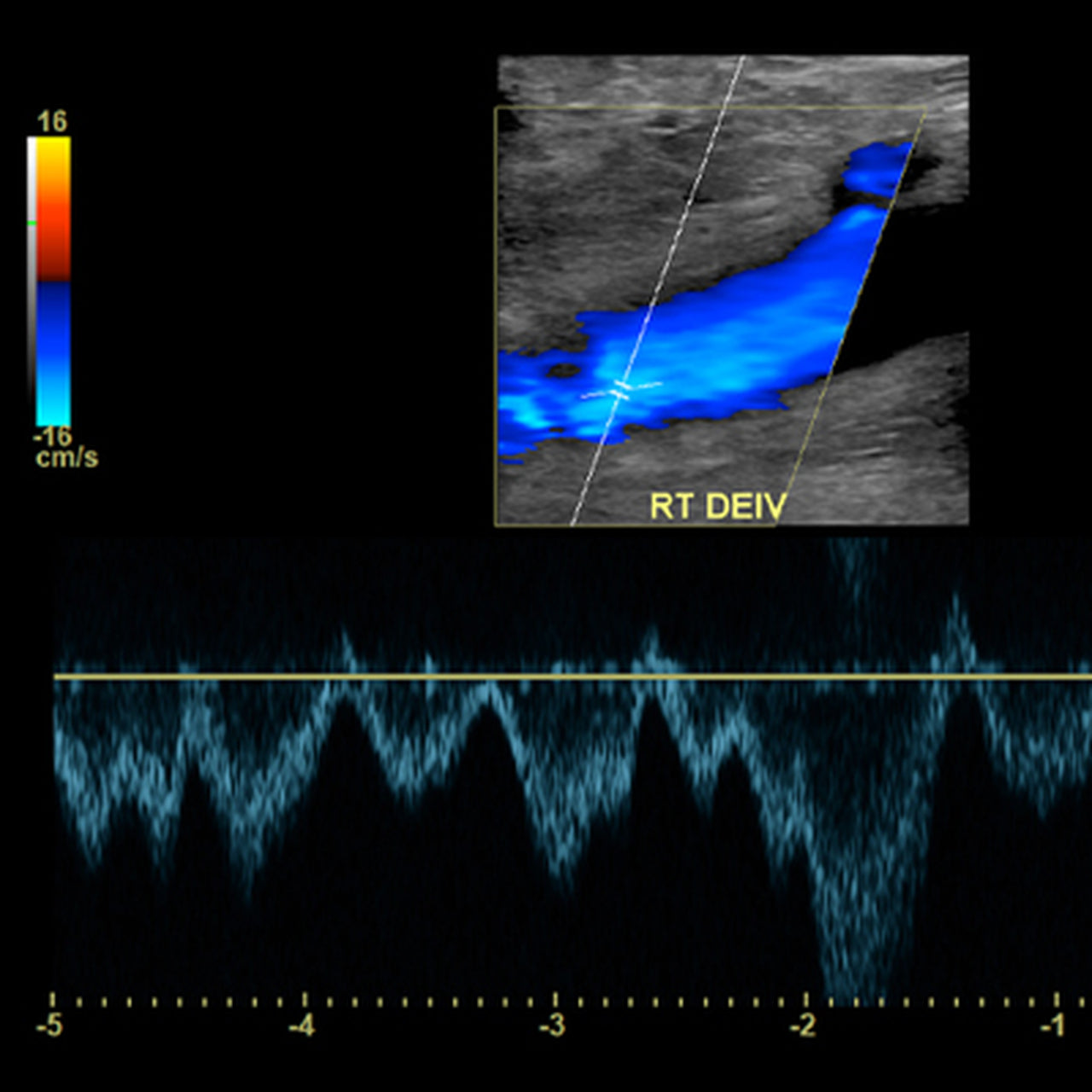 A Comprehensive Review of Vascular Ultrasound Interpretation & Registry Preparation 2020