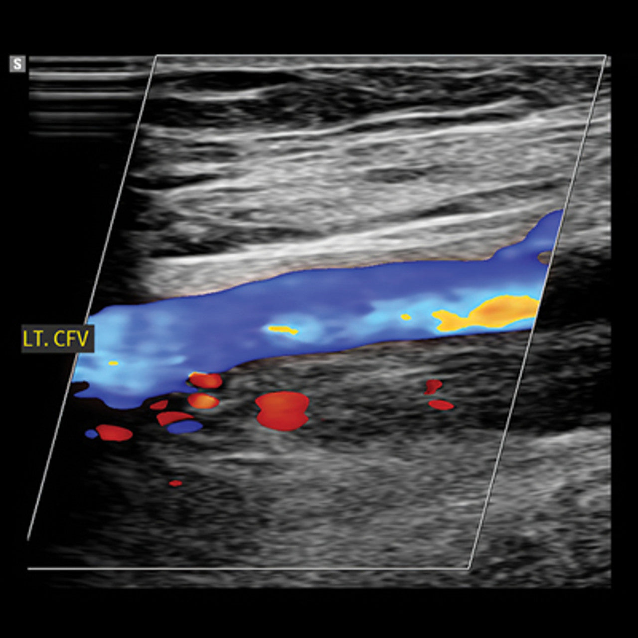 Clinical Approach to Vascular Ultrasound and RPVI Prep Course 2023