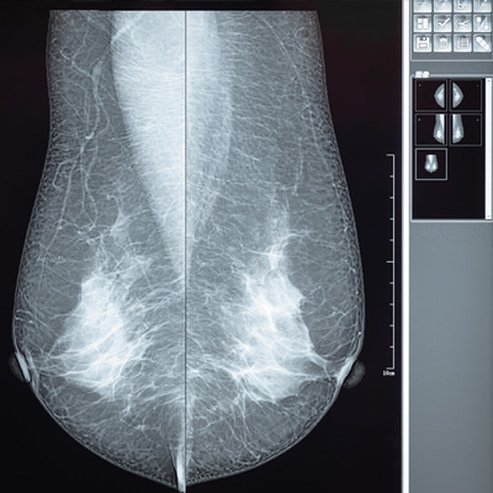 Comprehensive Review of Breast Imaging 2022