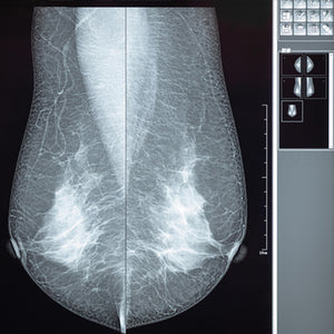 Comprehensive Review of Breast Imaging 2022