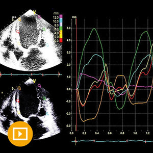 Echocardiography A Comprehensive Review 2022