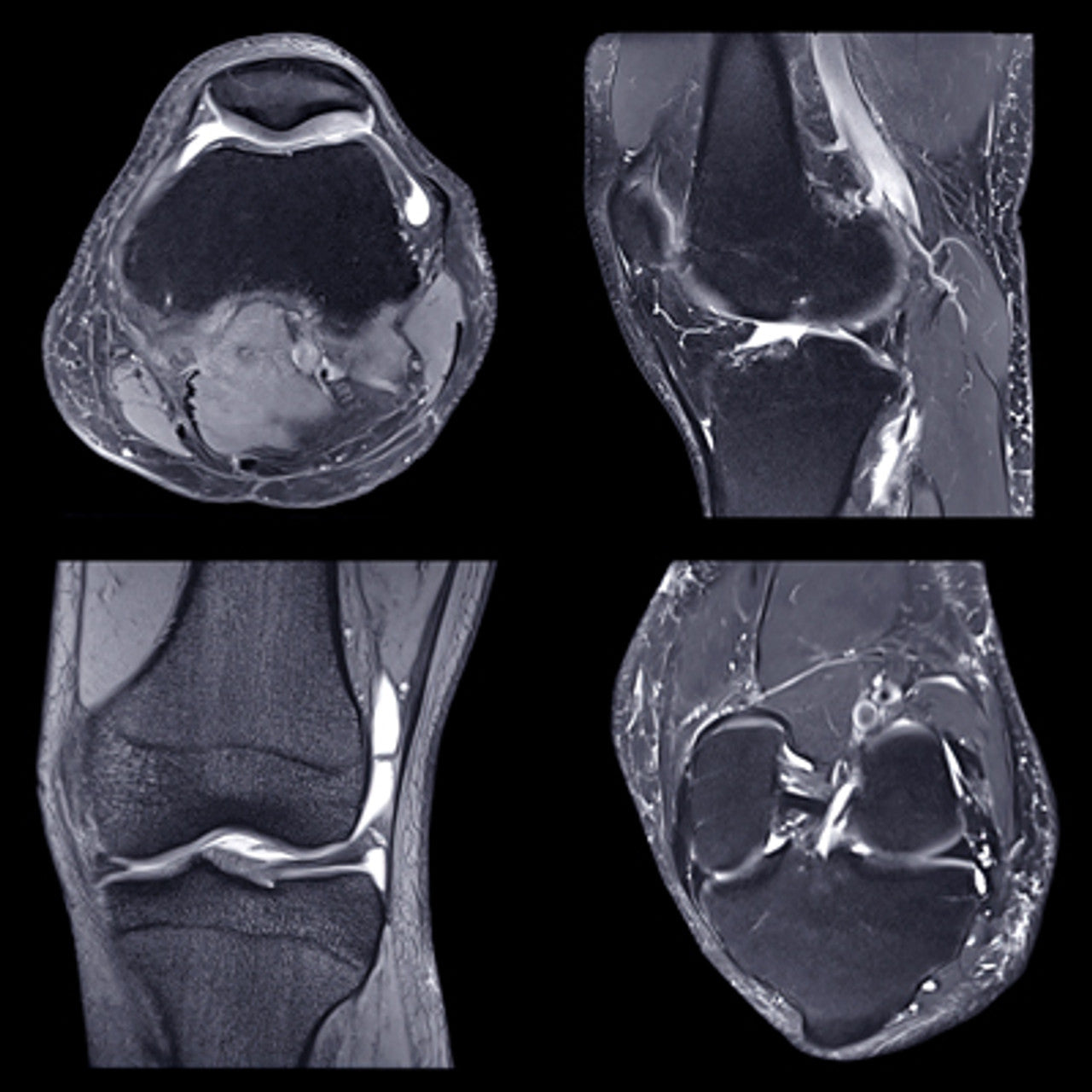 NYU Langone Advanced Imaging of the Musculoskeletal System Up Your Game 2023