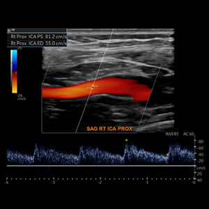 Society for Vascular Medicine Comprehensive Review of Vascular Ultrasound Interpretation and Registry Preparation 2023