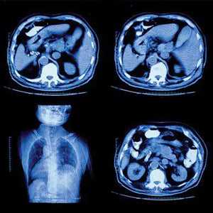 UCSF Abdominal & Thoracic Imaging 2022