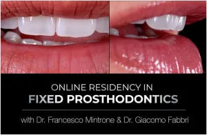 Online Residency Program in Fixed Prosthodontics: Esthetic and Functional Rehabilitation of Natural Teeth