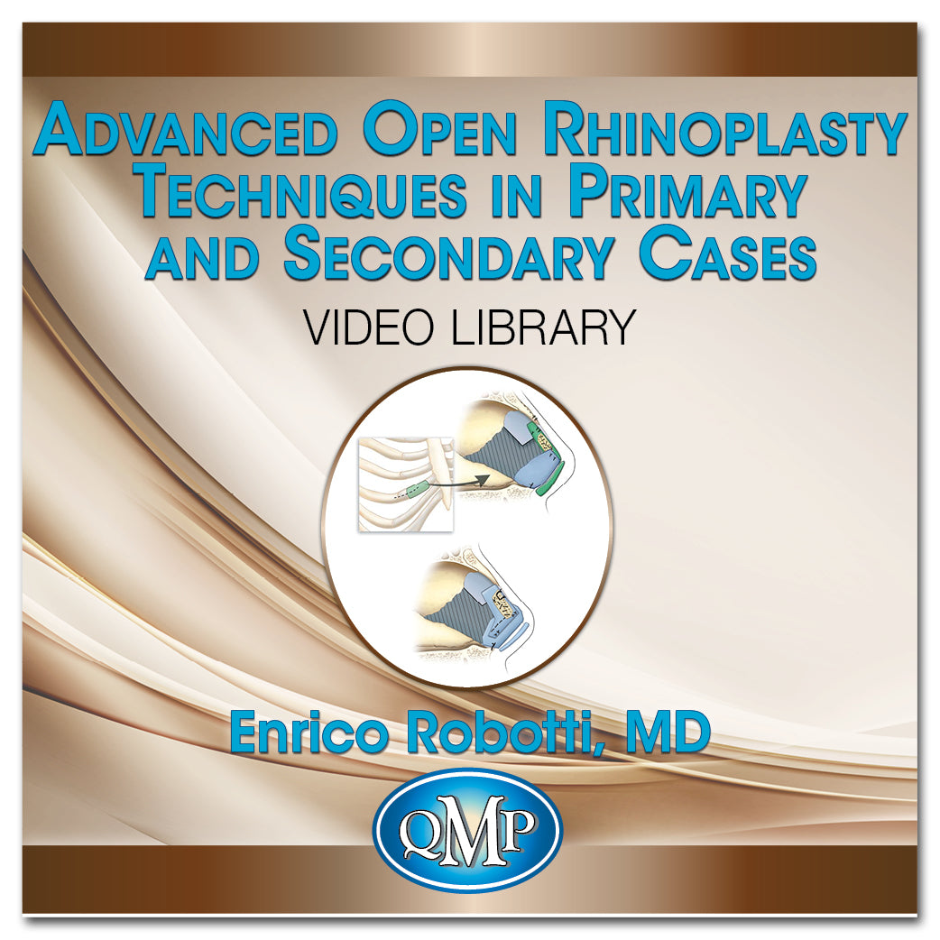 QMP Advanced Open Rhinoplasty Techniques in Primary and Secondary Cases 2016