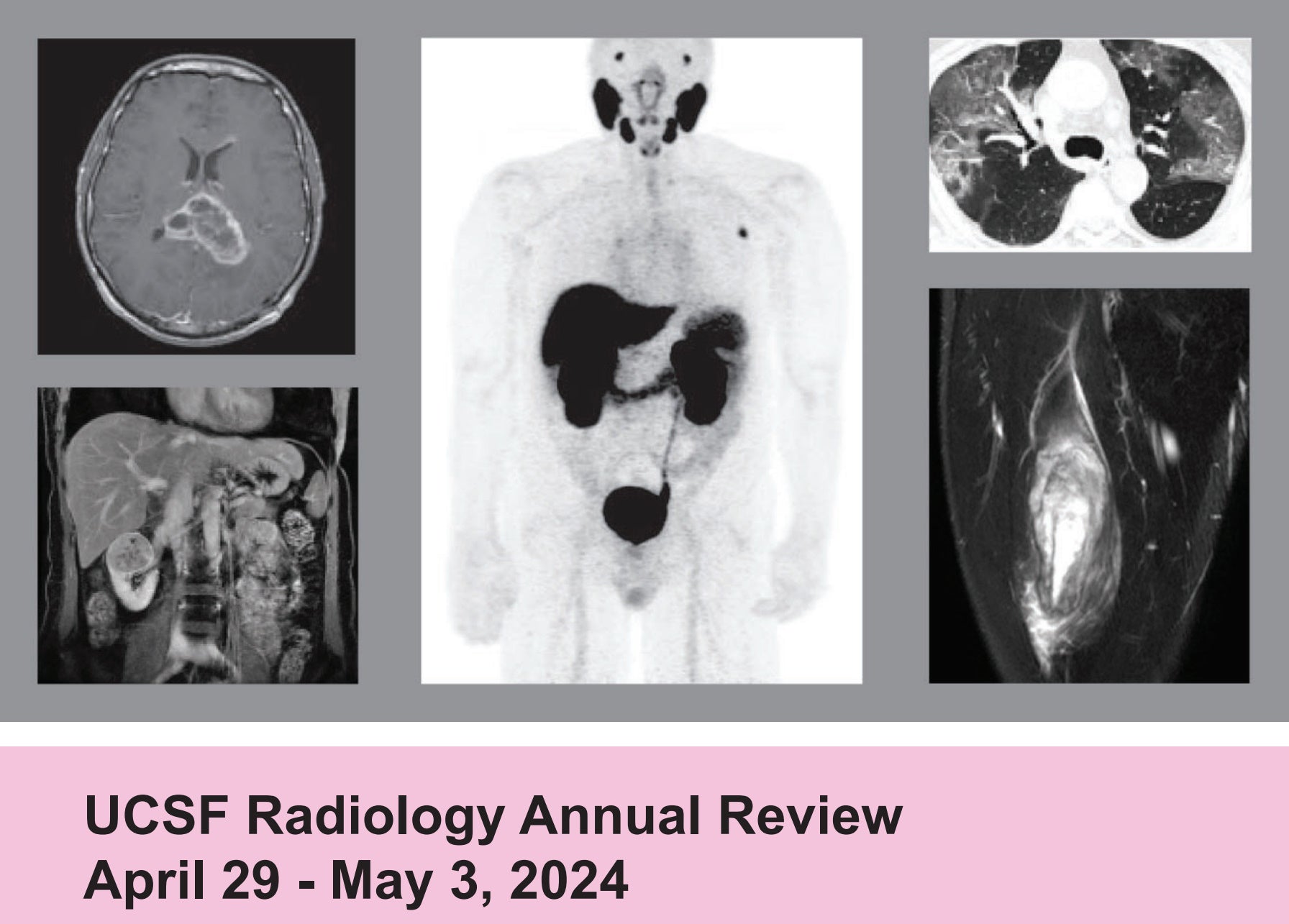 UCSF Radiology Annual Review 2024