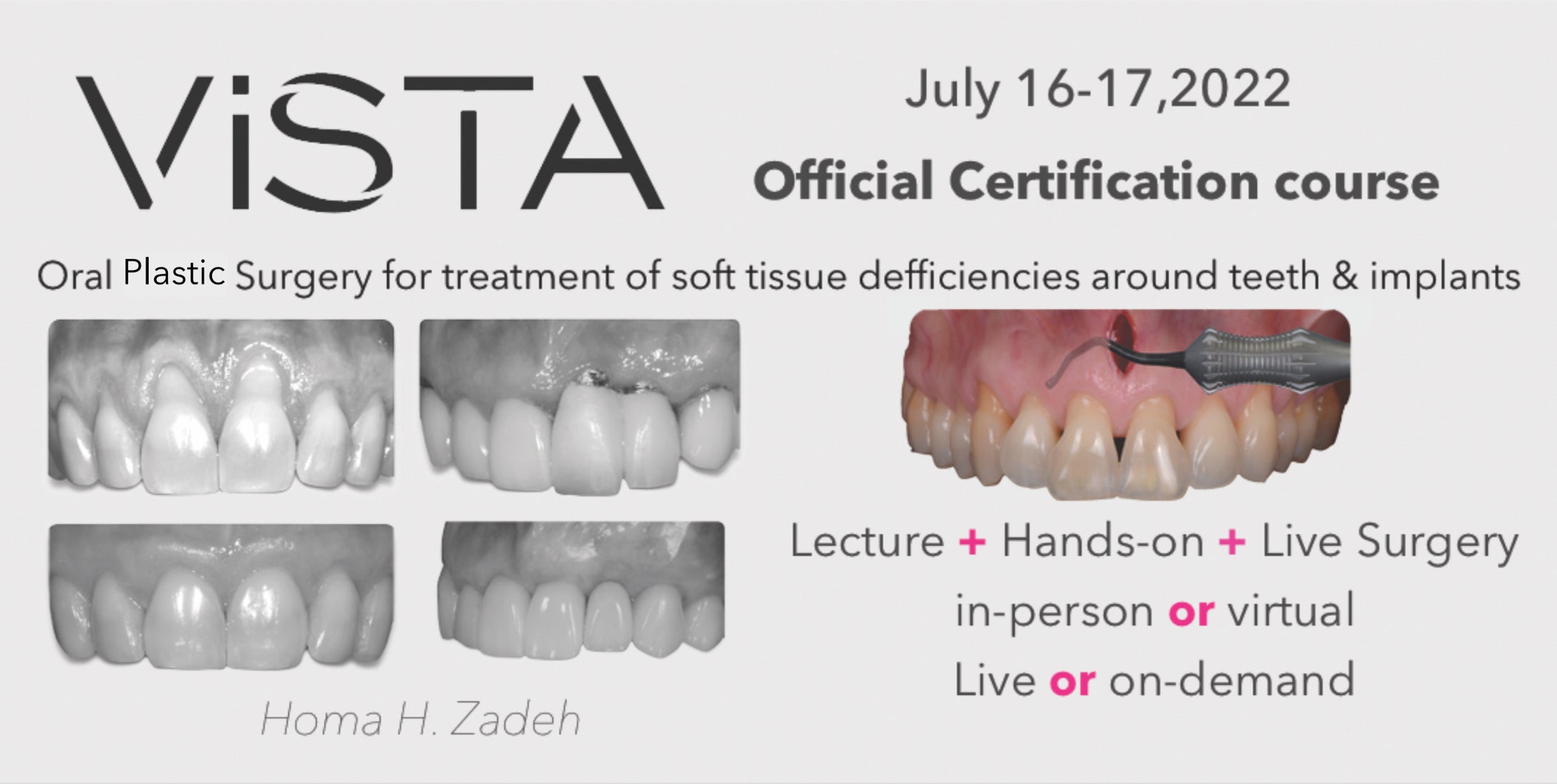 VISTA Institute for Therapeutic Innovations Oral Plastic Surgery for Treatment of Soft Tissue Deficiencies Around Teeth & Implants 2022