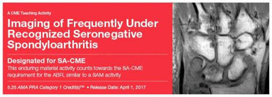 2017 imaging of frequently under recognized seronegative spondyloarthritis - Medical Videos | Board Review Courses