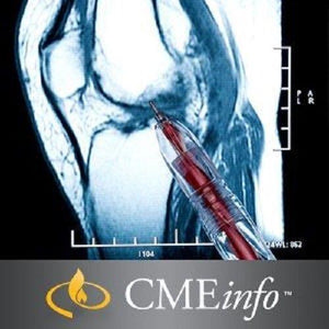 Advanced Imaging of Sports Related Joint Injuries - Medical Videos | Board Review Courses