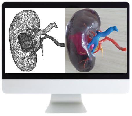 ARRS 3D Printing of Anatomic Models: Value Added Opportunity for Radiology 2019 - Medical Videos | Board Review Courses