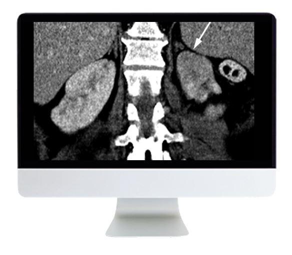 ARRS Abdominal and Thoracic Imaging Guidelines Applied: Evidence Versus Opinion 2021 - Medical Videos | Board Review Courses