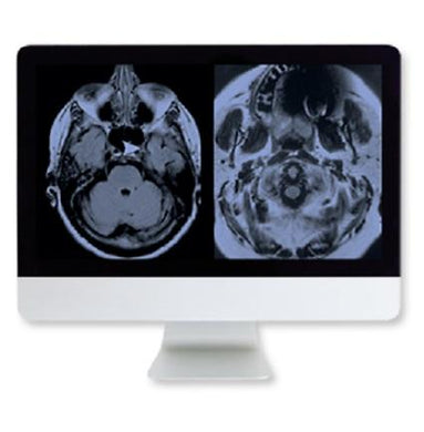 ARRS artifacts & physics in Daily imaging - A case-based Approach - Medical Videos | Board Review Courses