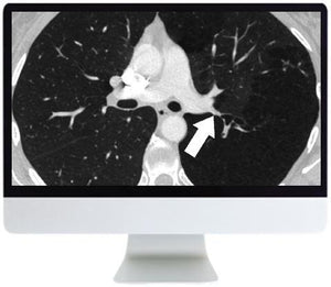 ARRS Basic Chest Imaging 2019 - Medical Videos | Board Review Courses