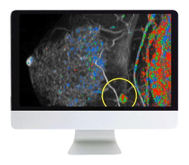ARRS Breast Imaging Pearls and Pitfalls: Traditional and Novel Imaging Approaches 2020 - Medical Videos | Board Review Courses
