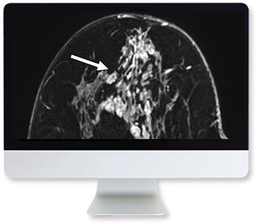 ARRS Clinical Case-Based Review of Breast Imaging 2019 - Medical Videos | Board Review Courses