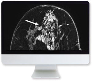 ARRS Clinical Case-Based Review of Breast Imaging 2019 - Medical Videos | Board Review Courses