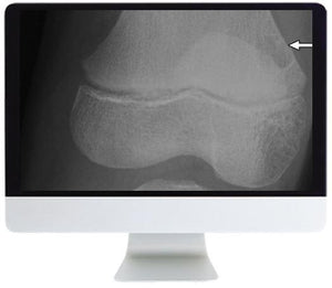 ARRS Clinical Case-Based Review of Musculoskeletal Imaging 2019 - Medical Videos | Board Review Courses