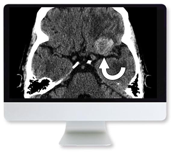 ARRS Clinical Case-Based Review of Neuroradiology 2019 - Medical Videos | Board Review Courses