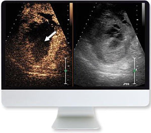 ARRS Clinical Case-Based Review of Ultrasound 2019 - Medical Videos | Board Review Courses