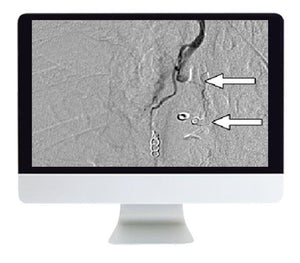 ARRS Clinical Case-Based Review of Vascular and Interventional Imaging 2019 - Medical Videos | Board Review Courses