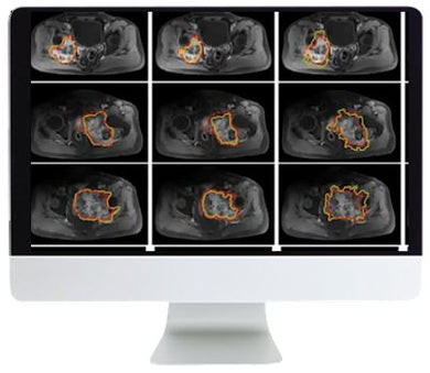 ARRS Crossroads of Computational Science and Musculoskeletal Imaging: Where Machine Magic Can Aid Radiologists 2021 - Medical Videos | Board Review Courses