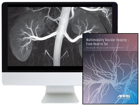 ARRS Multimodality Vascular Imaging: From Head to Toe 2020 - Medical Videos | Board Review Courses