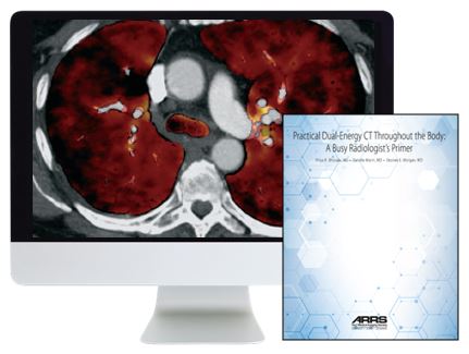 ARRS Practical Dual-Energy CT Throughout the Body 2021 - Medical Videos | Board Review Courses