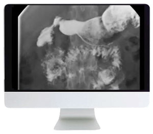 ARRS Practical Pediatric Imaging 2021 - Medical Videos | Board Review Courses