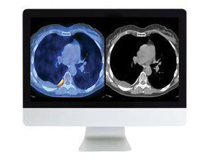 ARRS Practical PET/CT: What You Need to Know - Medical Videos | Board Review Courses