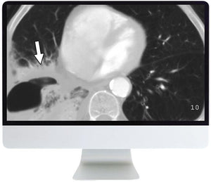 ARRS Radiology Review: Multispecialty Cases 2019 - Medical Videos | Board Review Courses