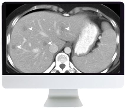 ARRS SAR Disease-Focused Panels: Cancer Imaging and Reporting Guidelines 2021 - Medical Videos | Board Review Courses
