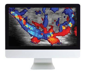 ARRS Thyroid Imaging - Medical Videos | Board Review Courses