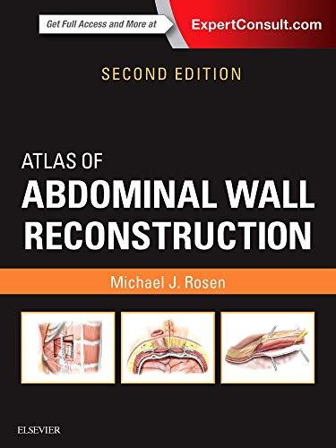 Atlas of Abdominal Wall Reconstruction, 2nd Edition (Videos, Organized) - Medical Videos | Board Review Courses