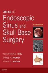 Atlas of Endoscopic Sinus and Skull Base Surgery, 2nd Edition (Videos, Organized) - Medical Videos | Board Review Courses